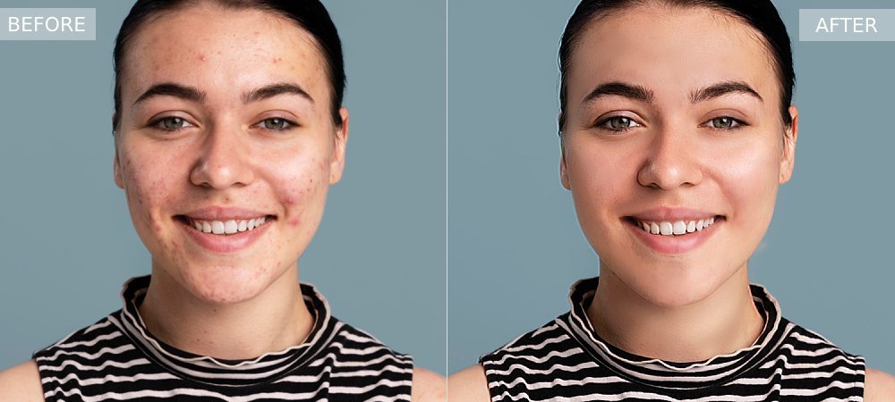 outsource image enhancement services